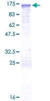 Human ABR Protein (Recombinant GST)