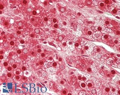 IHC-plus™ ACP1 / Acid Phosphatase Antibody (clone 4B10)