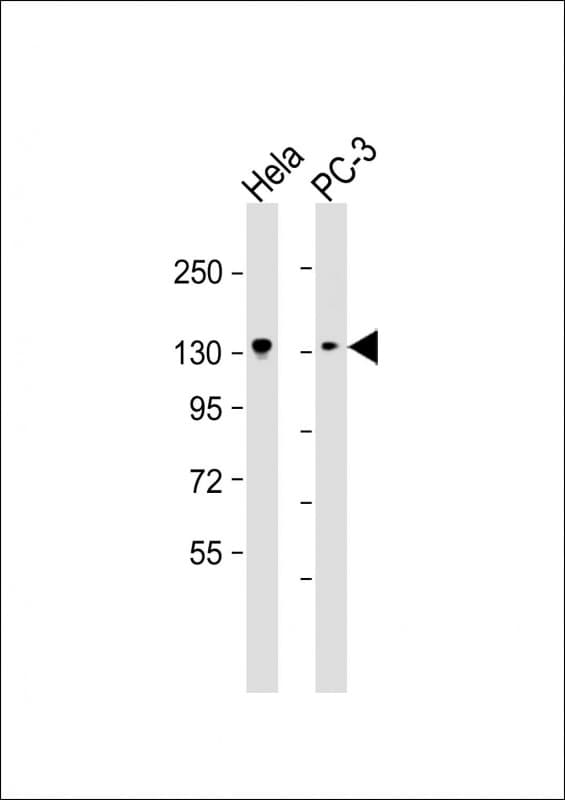 KIF1B / CMT2 Antibody (aa770-1153, clone 1521CT681.1.2)