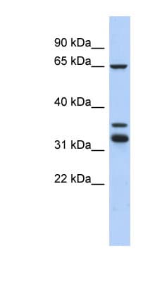 S100PBP Antibody (C-Terminus)