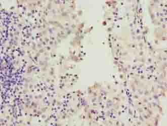 Polyclonal Rabbit anti-Human RAB20 Antibody (IHC, WB)