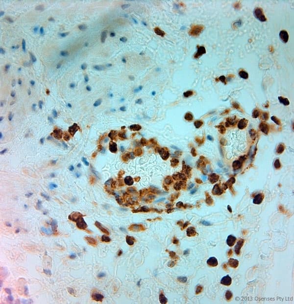 MPO / Myeloperoxidase Antibody