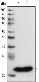 GSTP1 / GST Pi Antibody (clone 3F2C2)