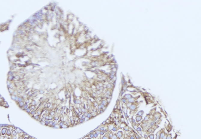 Polyclonal Rabbit anti-Human REEP5 Antibody (IHC, WB)