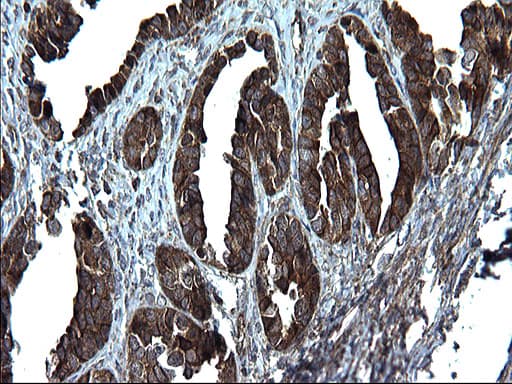 Monoclonal Mouse anti-Human PDCD6IP / ALIX Antibody (clone OTI1A4, IHC, WB)