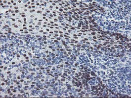 Monoclonal Mouse anti-Human MEIS3 Antibody (clone OTI3C9, IHC, WB)