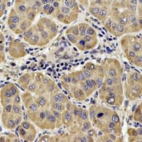 DLST / E2 Antibody