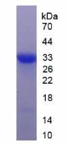 Human DKK1 Protein (Recombinant His, N-Terminal)