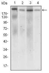 DNMT / DNMT1 Antibody (aa1448-1594, clone 7C11A2)