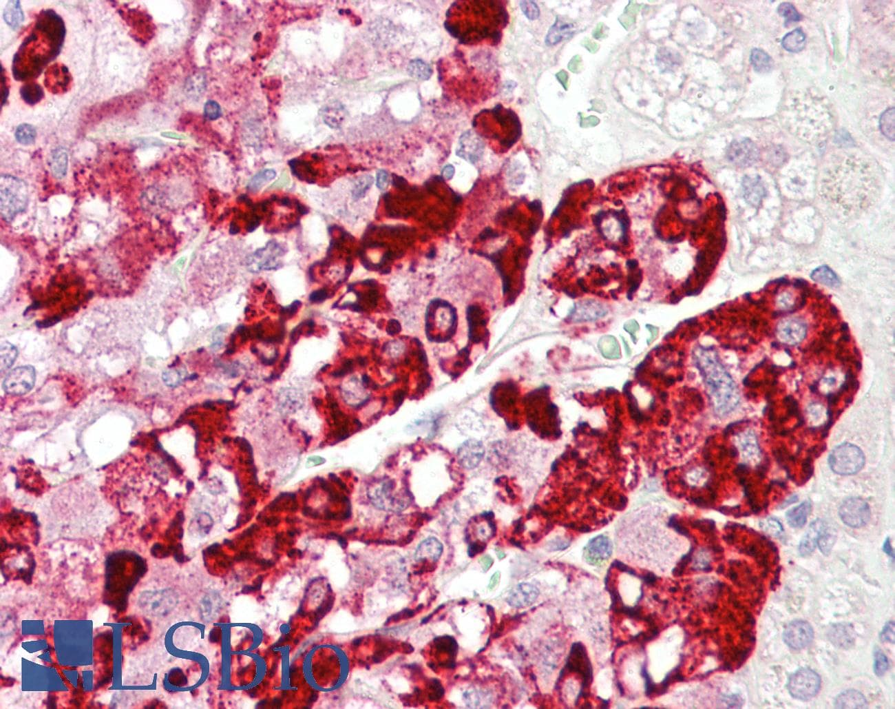 IHC-plus™ SPHKAP Antibody (C-Terminus)
