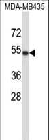 TUBA4A / TUBA1 Antibody (aa417-446)
