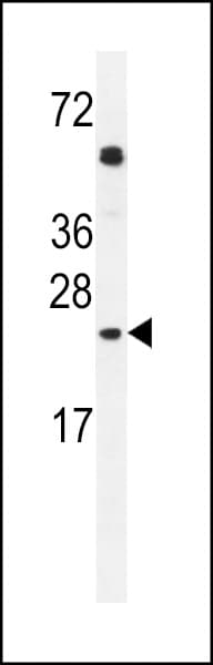 GOLGA2P5 Antibody (aa 83-112, C-term)