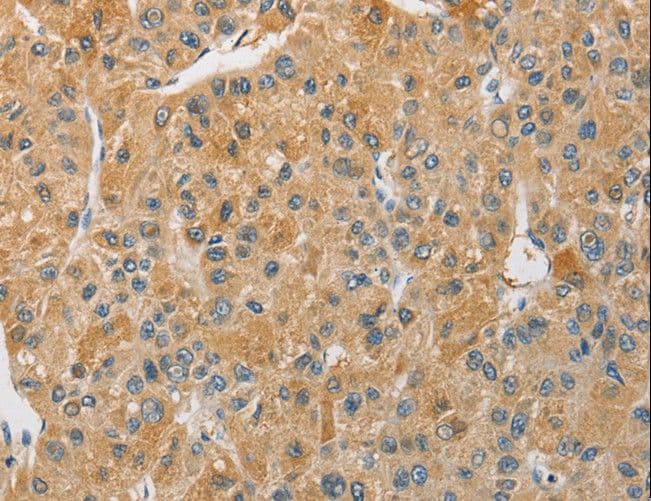 Polyclonal Rabbit anti-Human ARHGAP15 Antibody (IHC)