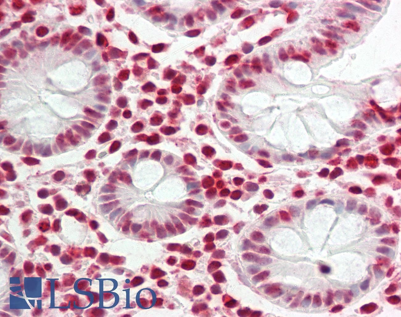 PBRM1 / BAF180 / PB1 Antibody (aa31-80)