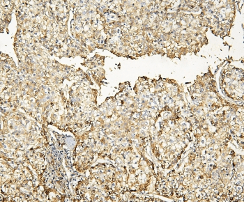 HP / Haptoglobin Antibody