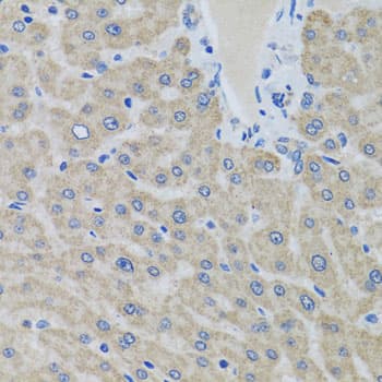 EIF2S3 / EIF2G Antibody