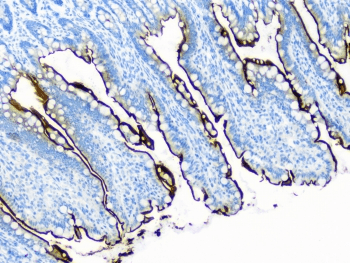 SI / Sucrase Isomaltase Antibody