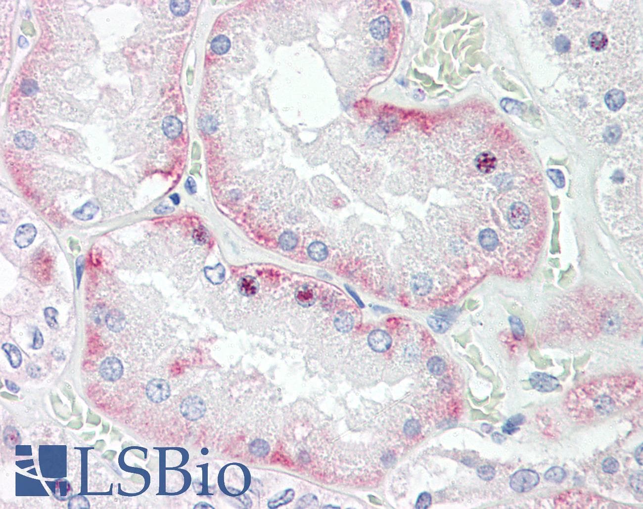 IHC-plus™ HOXD10 Antibody (aa84-97)