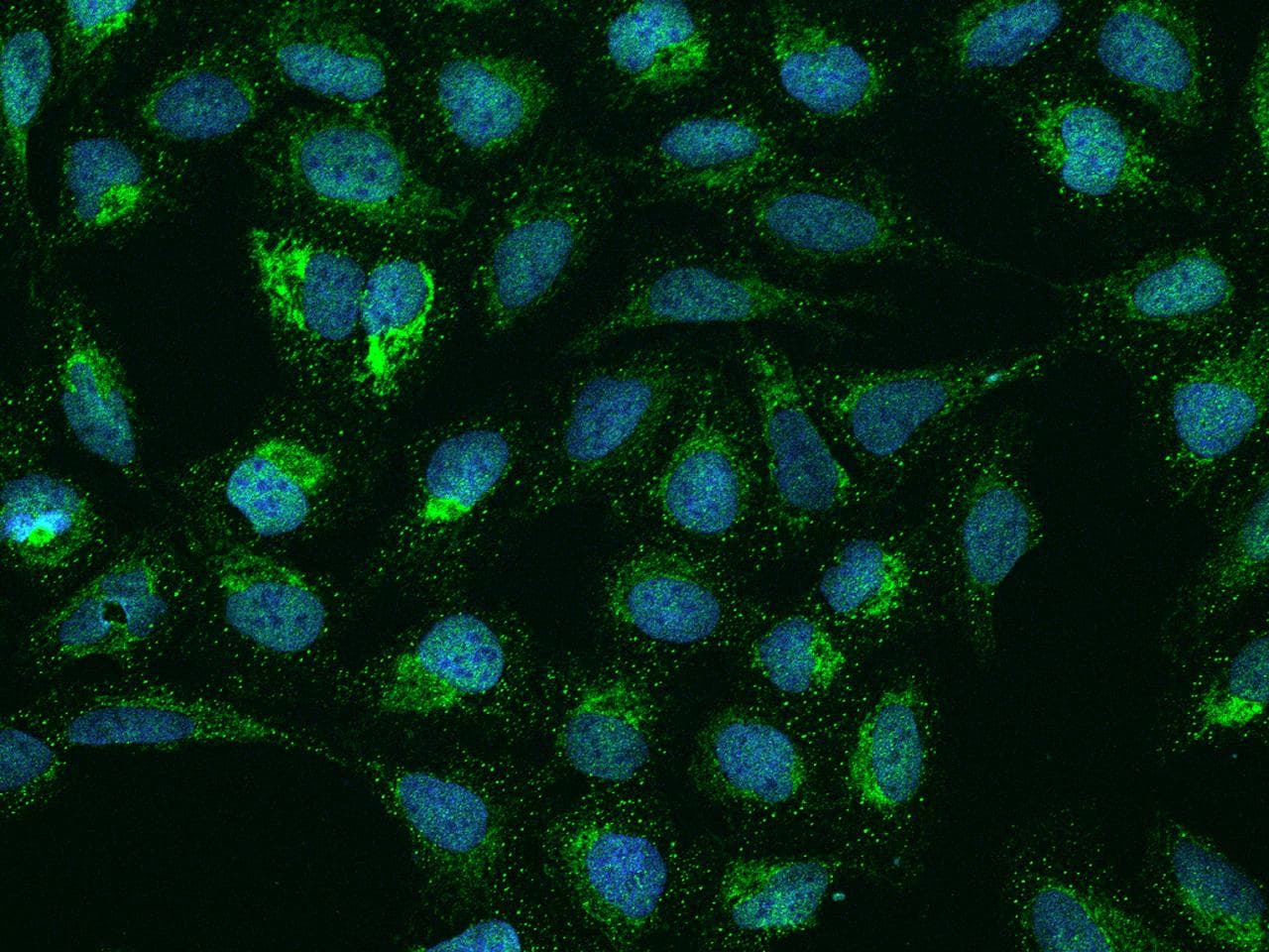 SMIM4 Antibody