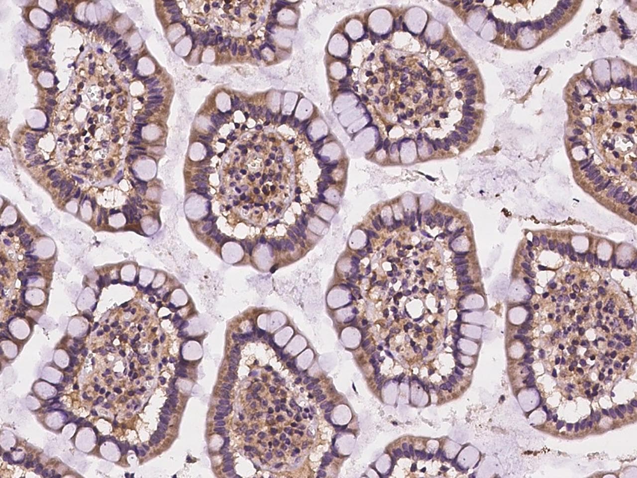CELSR2 Antibody