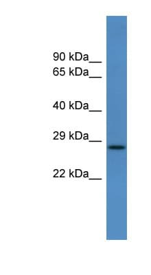 CALY Antibody (aa141-190)