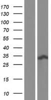 RCD1 / RQCD1 Protein (Over-Expression Lysate Myc-DDK (Flag))