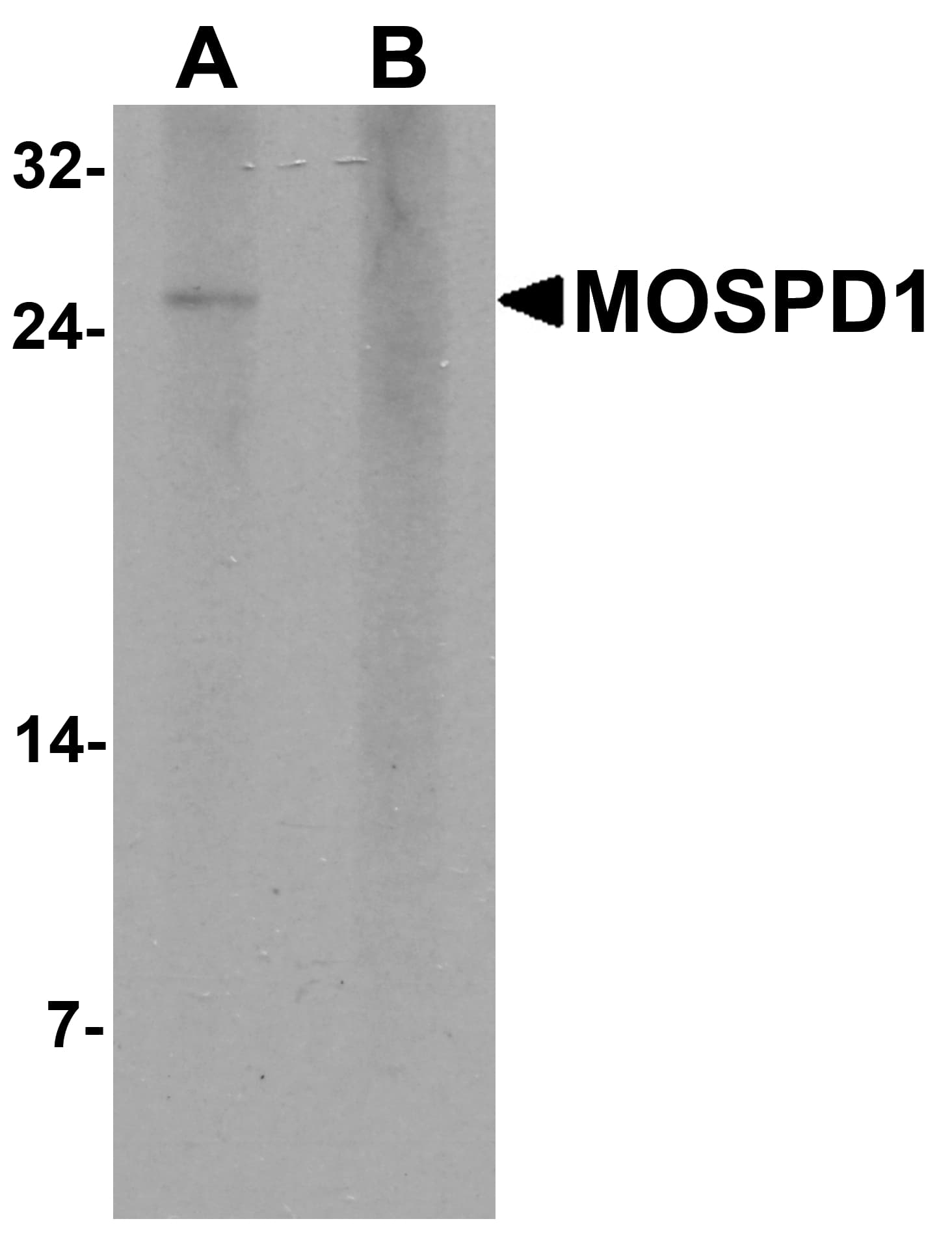 IHC-plus™ MOSPD1 Antibody