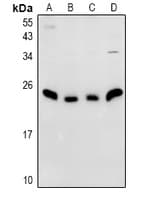NDFIP1 / N4WBP5 Antibody