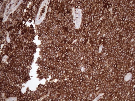 URP2 / FERMT3 Antibody (aa259-528, clone OTI2G2)