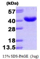 Human AKR7A3 Protein (Recombinant His)