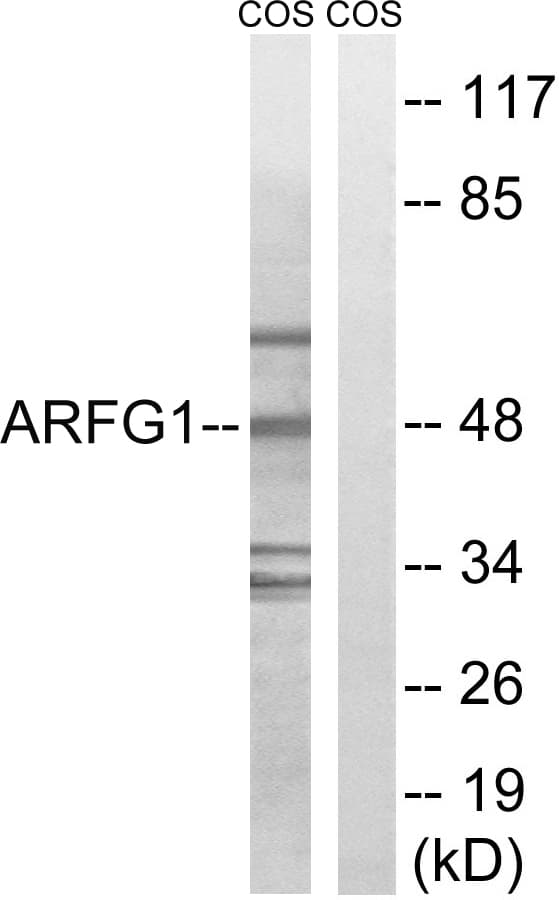 Polyclonal Rabbit anti-Human ARFGAP1 Antibody (aa171-220, IF, WB)
