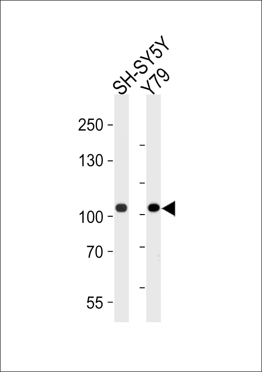 Polyclonal Rabbit anti-Human CDH8 / Cadherin 8 Antibody (aa33-63, IHC, WB)