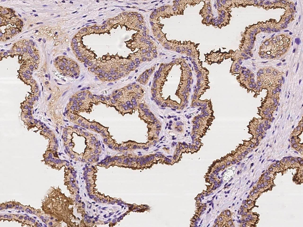 Polyclonal Rabbit anti-Human TSPAN1 / TM4SF Antibody (IHC)
