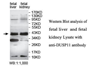 DUSP11 Antibody (aa2-179)