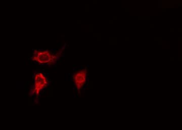 CLU / Clusterin Antibody