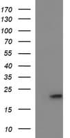 Monoclonal Mouse anti-Human C17orf62 Antibody (clone OTI3F10, WB)