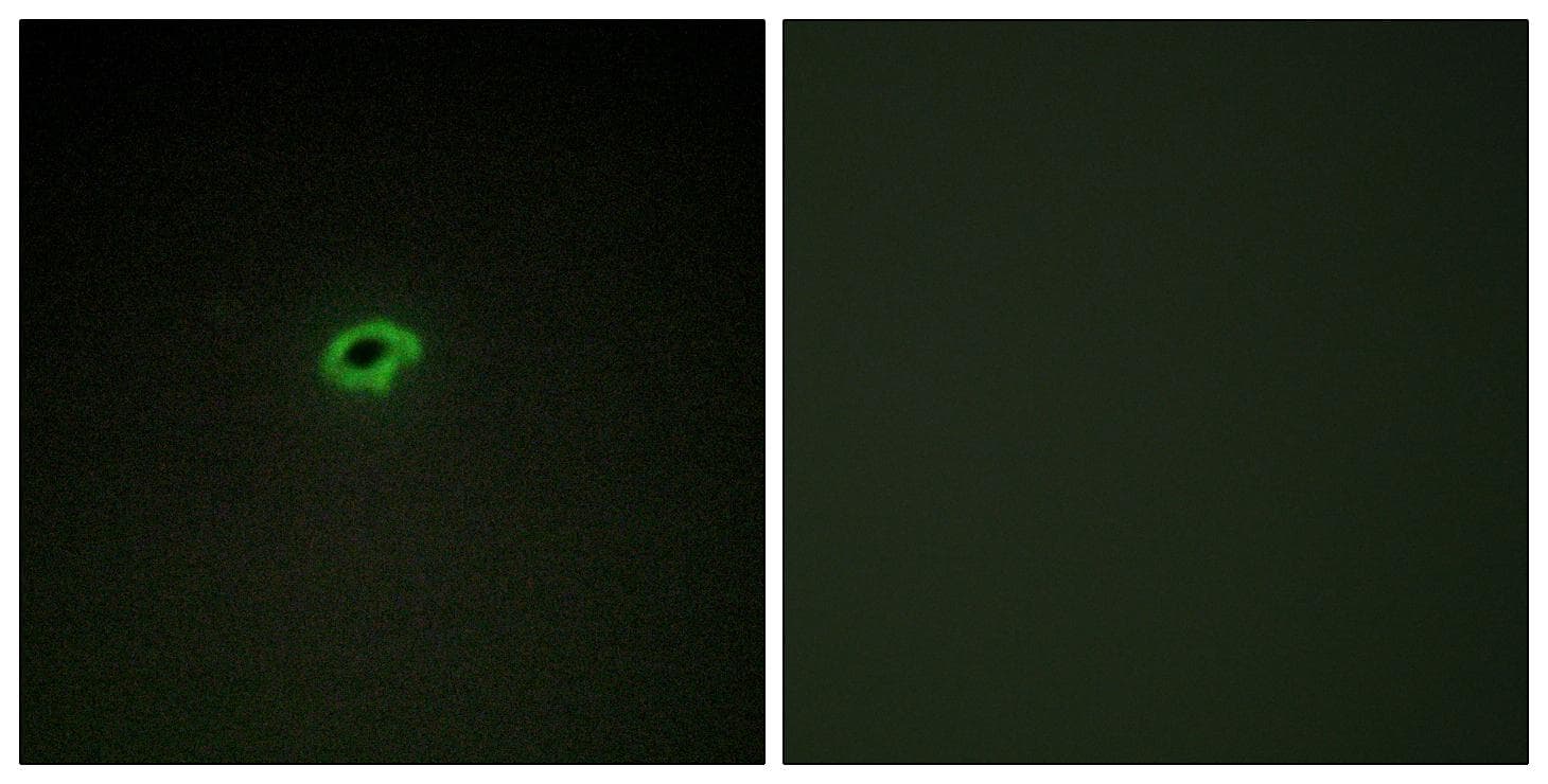 COL4A4 / Collagen IV Antibody