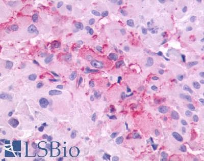PathPlus™ GRM3 / MGLUR3 Antibody (N-Terminus)