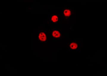 ZBTB40 Antibody