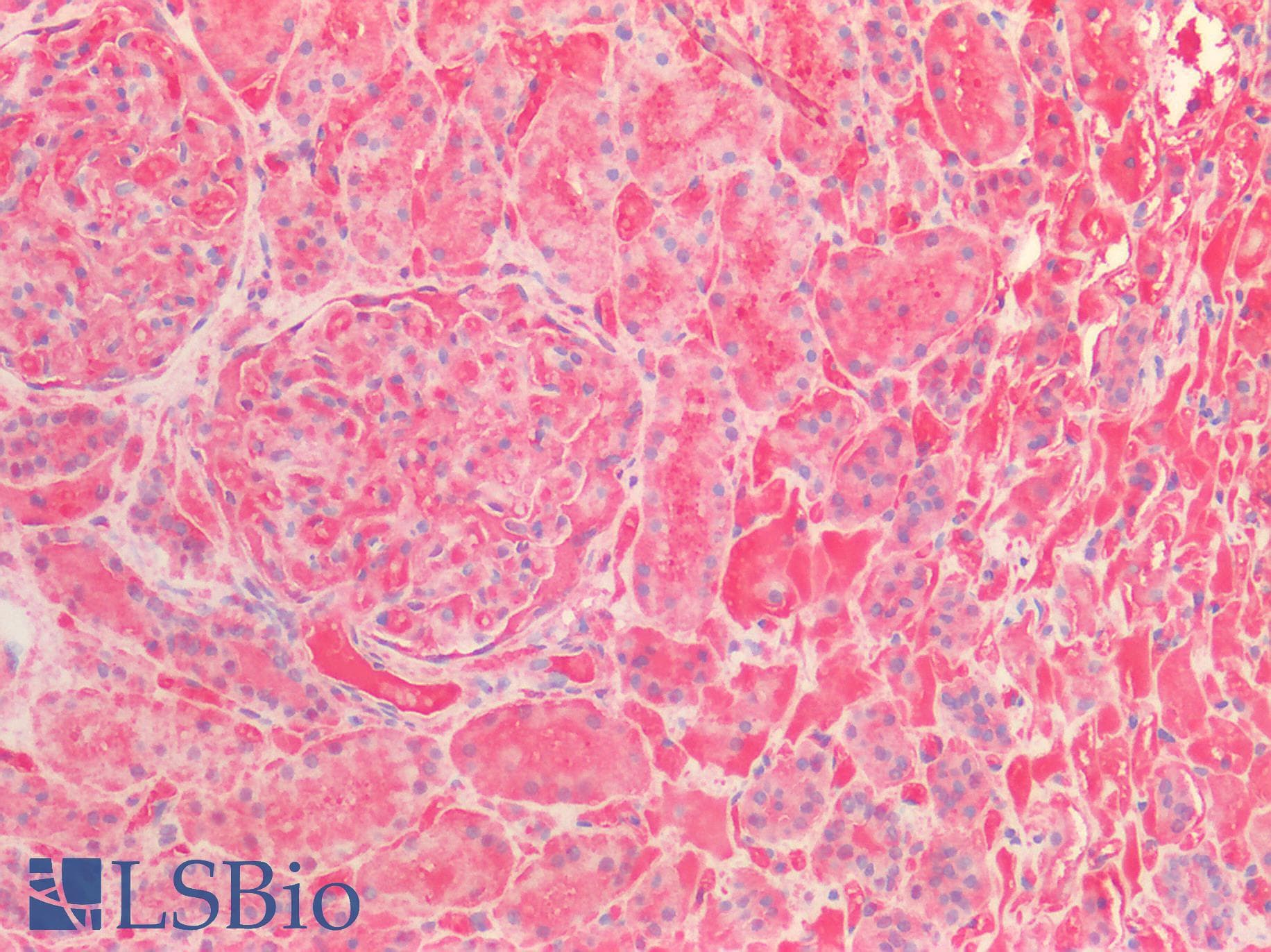 PathPlus™ Polyclonal Rabbit anti-Human ENO1 / Alpha Enolase Antibody (IHC, IF, WB)