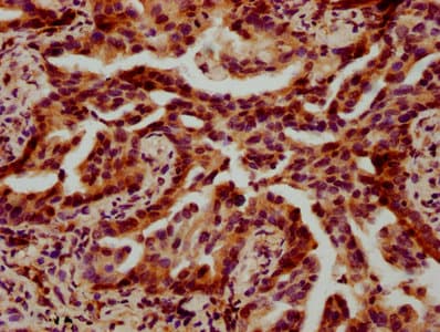 Polyclonal Rabbit anti-Human HIST1H4I Antibody (IHC)