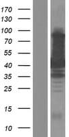 TAB1 Protein (Over-Expression Lysate Myc-DDK (Flag))