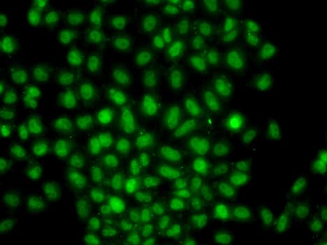 Polyclonal Rabbit anti-Human CIDEA / CIDE-A Antibody (IF, WB)