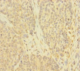Polyclonal Rabbit anti-Human TNFAIP6 / TSG-6 Antibody