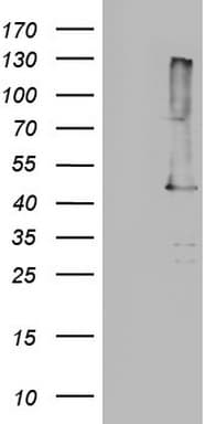 TP53 / p53 Antibody (clone DO-1)