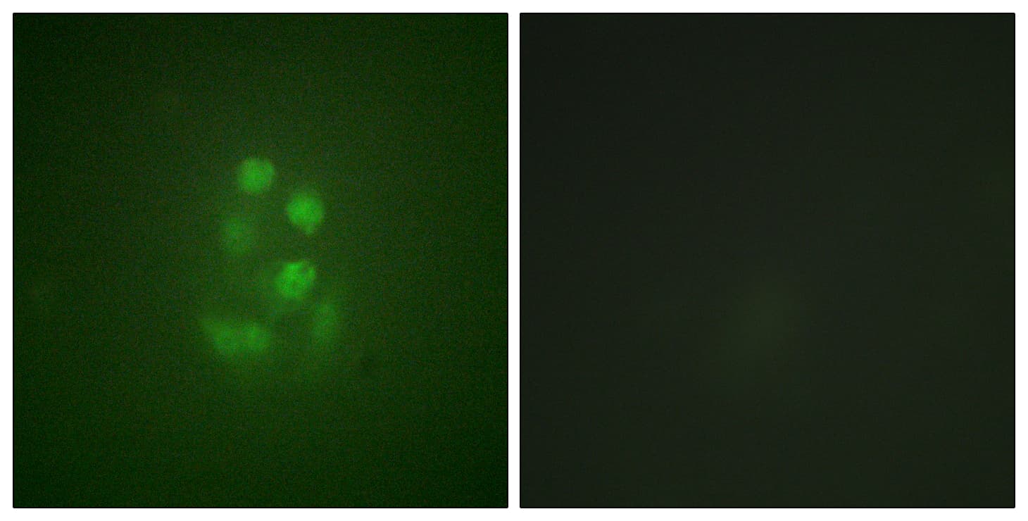 KIF2C / MCAK Antibody (phospho-Ser95)