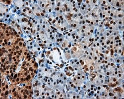 LTA4H / LTA4 Antibody (clone OTI7D11)