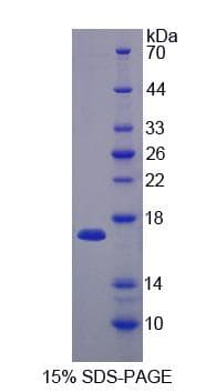 Human SH3BGRL Protein (Recombinant His-S)