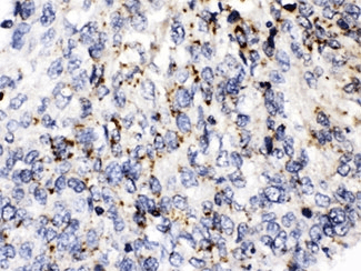 PLIN3 / M6PRBP1 / TIP47 Antibody