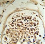 Polyclonal Rabbit anti-Human MOB2 Antibody (aa5-32, IHC, WB)